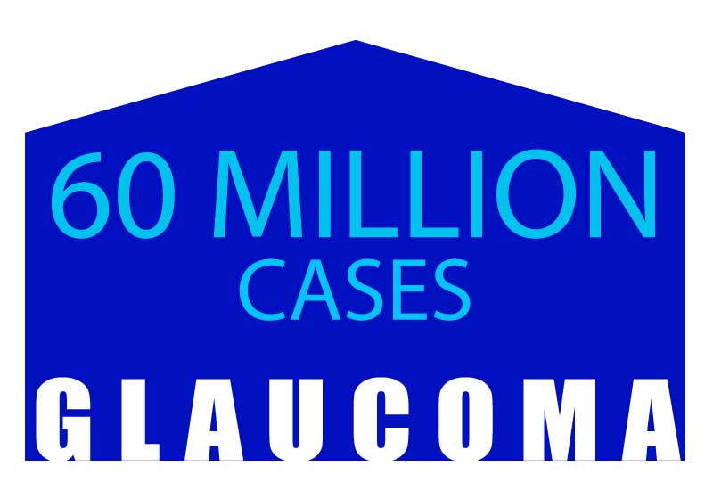 glaucoma 60 million cases